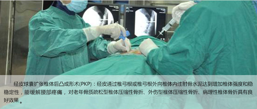 经皮球囊扩张椎体后凸成形术(pkp)